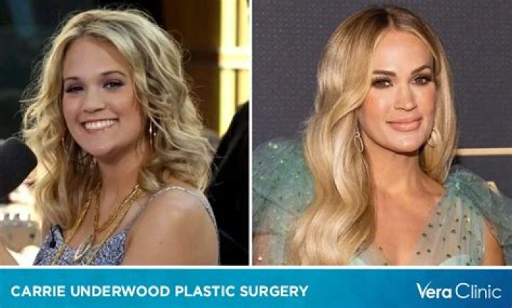 
Did Carrie Underwood Lose Weight Or Is It Plastic Surgery? Here Are Before And After Pictures 