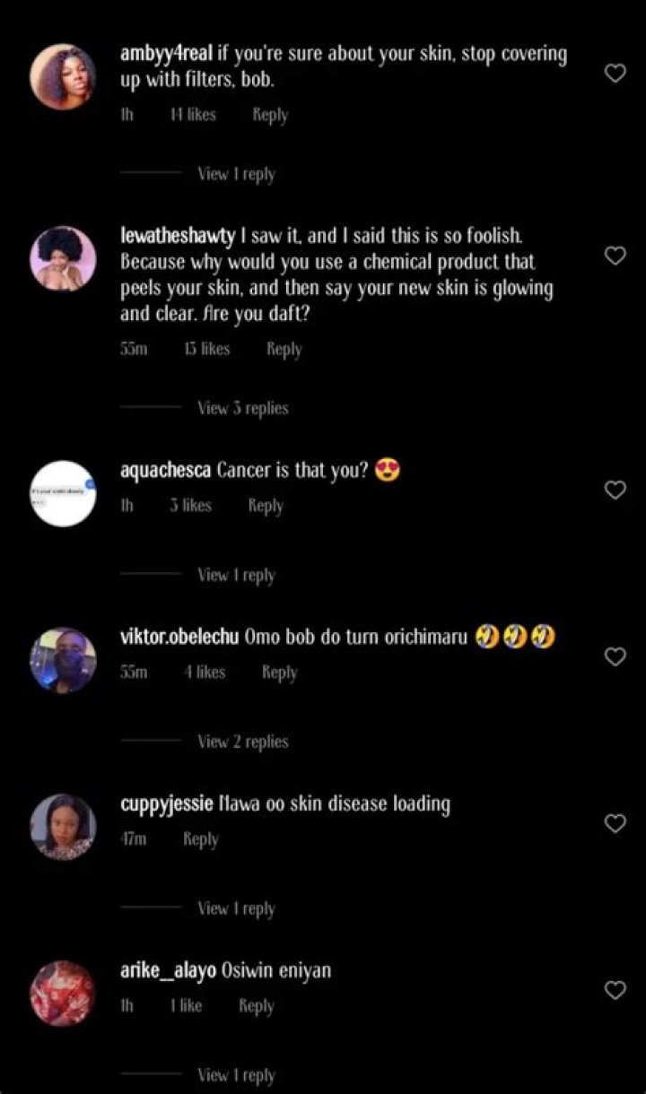 
“Senior Man Wetin Dey Occur? Are You A Snake?” – Bobrisky Dragged After Revealing His New ‘skin Peeling’ Process 