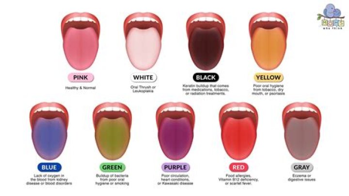 What Does The TikTok Spell “Honey Cross On Tongue” Mean?